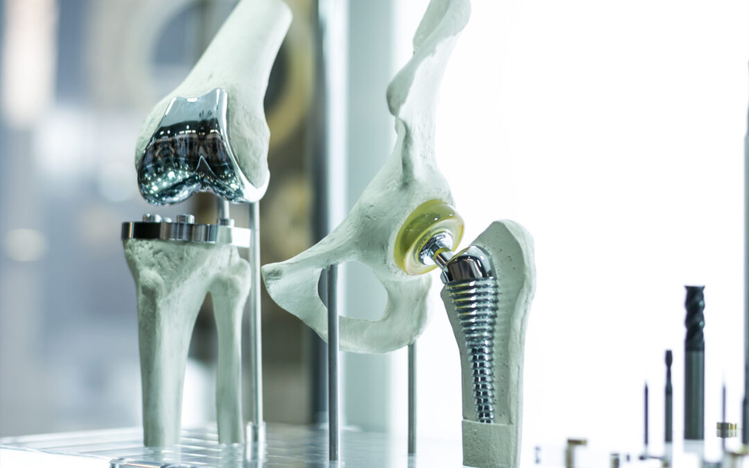 Common Causes Leading to Joint Replacement